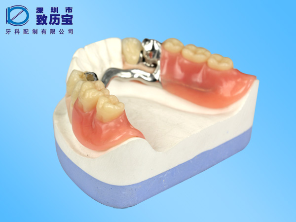 精密附件