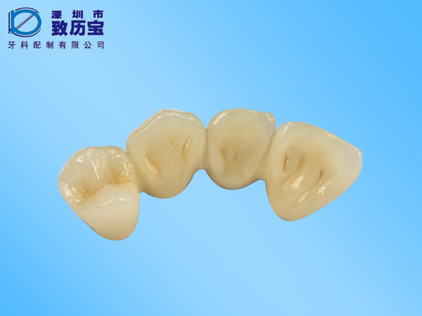 黄金烤瓷牙