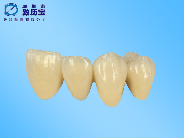 钴铬瓷牙