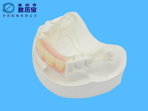 The invisible denture