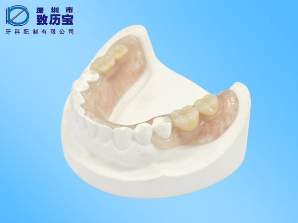 The invisible denture