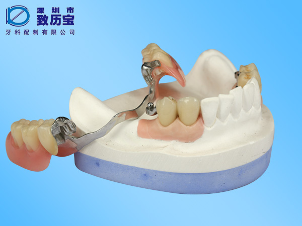 Precision attachment