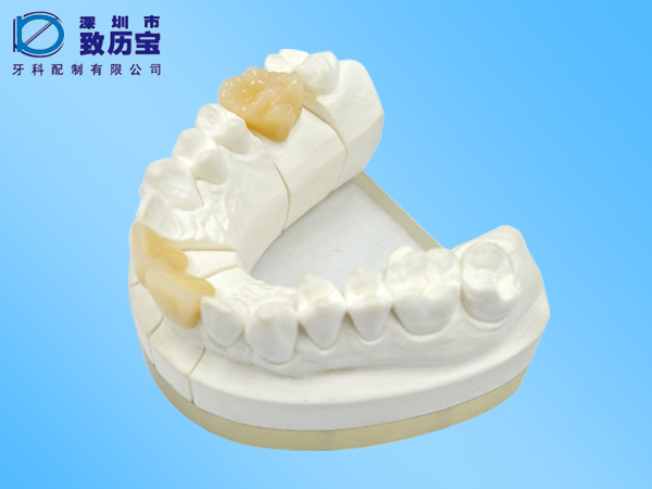 Porcelain teeth
